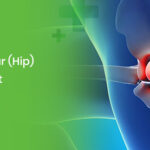 labral tear hip treatment