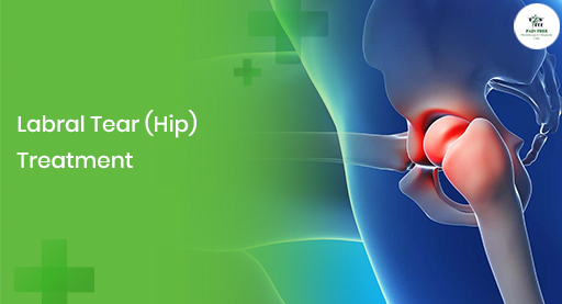 labral tear hip treatment