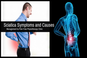 Sciatica – Symptoms and Causes