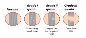 Knee Ligament Injuries1