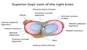 Meniscus Tear3