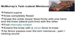 Meniscus Tear5