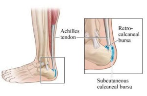 retrocalcaneal bursa pain