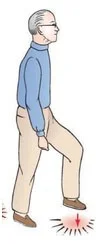 High stepping