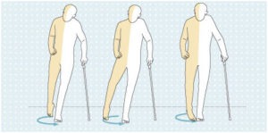 Circumduction gait