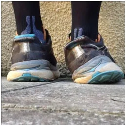 Altered Gait Patterns