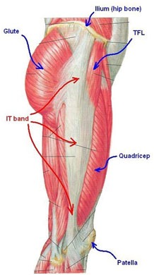 IT Band Friction Syndrome Physiotherapy in Dwarka | Pain Free Physiotherapy