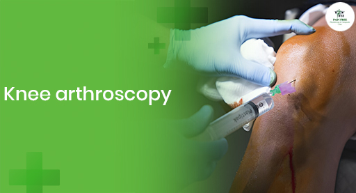 Knee arthroscopy