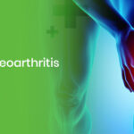 Knee Osteoarthritis