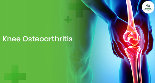 Knee Osteoarthritis