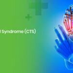 Carpal Tunnel Syndrome