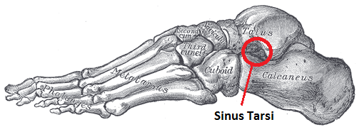 Sinus-Tarsi