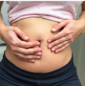 Check for Navel Displacement at Home