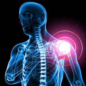 Shoulder & Arm Pain