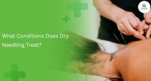 What Conditions Does Dry Needling Treat?